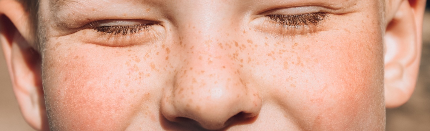 pecas en niños