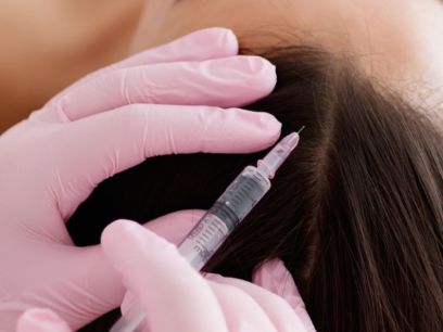 391.-tratamientos-para-alopecia-dr-sergio-vano