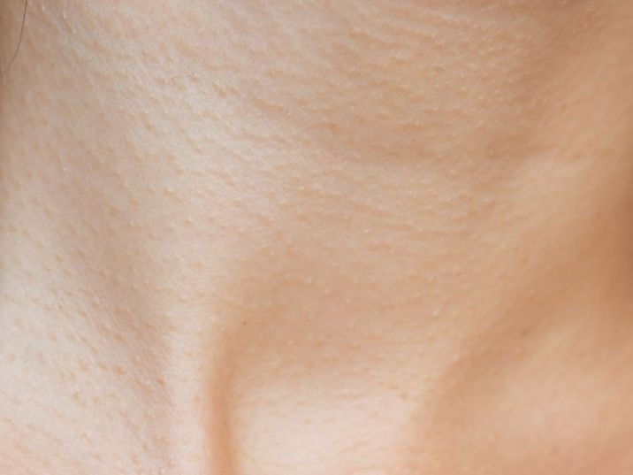 438.-como-cuidar-y-proteger-la-piel-del-sol-dermatologa-maria-porrino