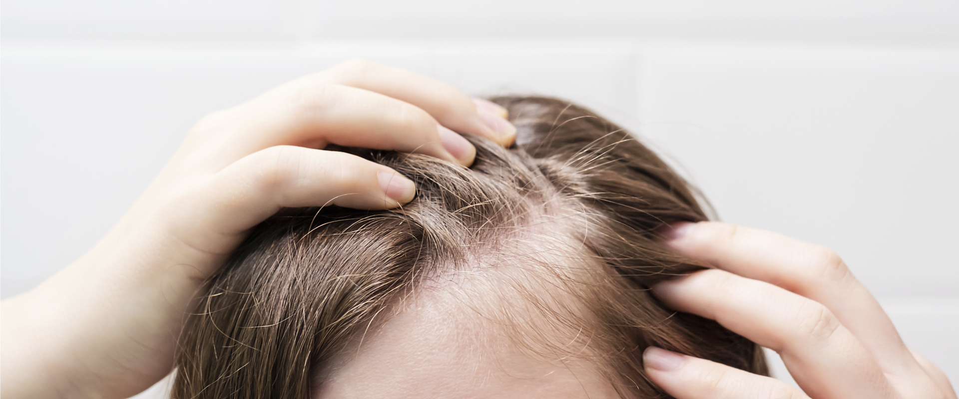 Hero home_alopecia_1920x800