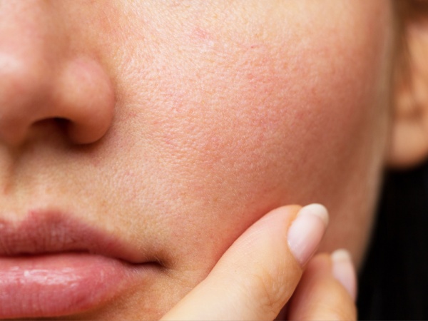 limpiador facial acido glicolico